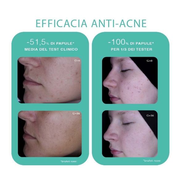 Gel detergente viso pelle impura MINI SIZE Trio Zinc Novexpert | Gelée moussante peau nette MINI SIZE Trio Zinc