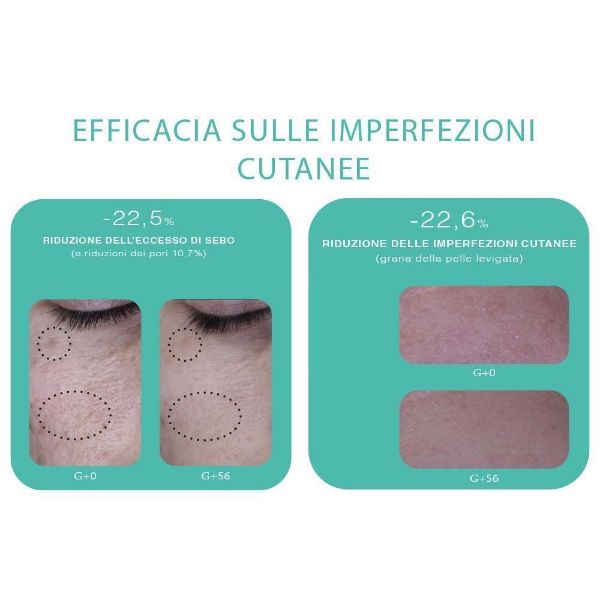 Gel detergente viso pelle impura MINI SIZE Trio Zinc Novexpert | Gelée moussante peau nette MINI SIZE Trio Zinc