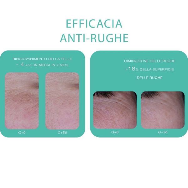 Effetto Gel detergente anti acne Trio Zinc Novexpert	